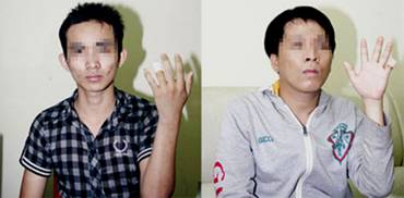 http://www.vietvungvinh.com/2013/images/stories/2013-01/Other/con-bac-bi-chat-ngon-tay.jpg
