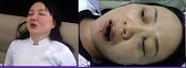 ImgOfHDPR